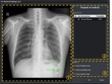 ,  AI ܺ ַ VXCAD-CXR ľó 㰡 